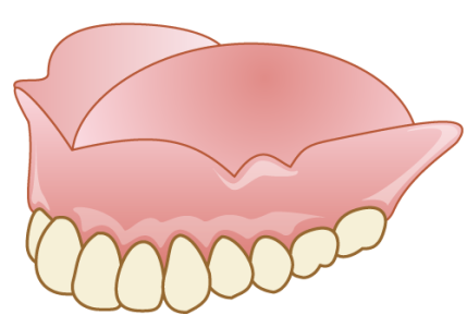 レジン床義歯