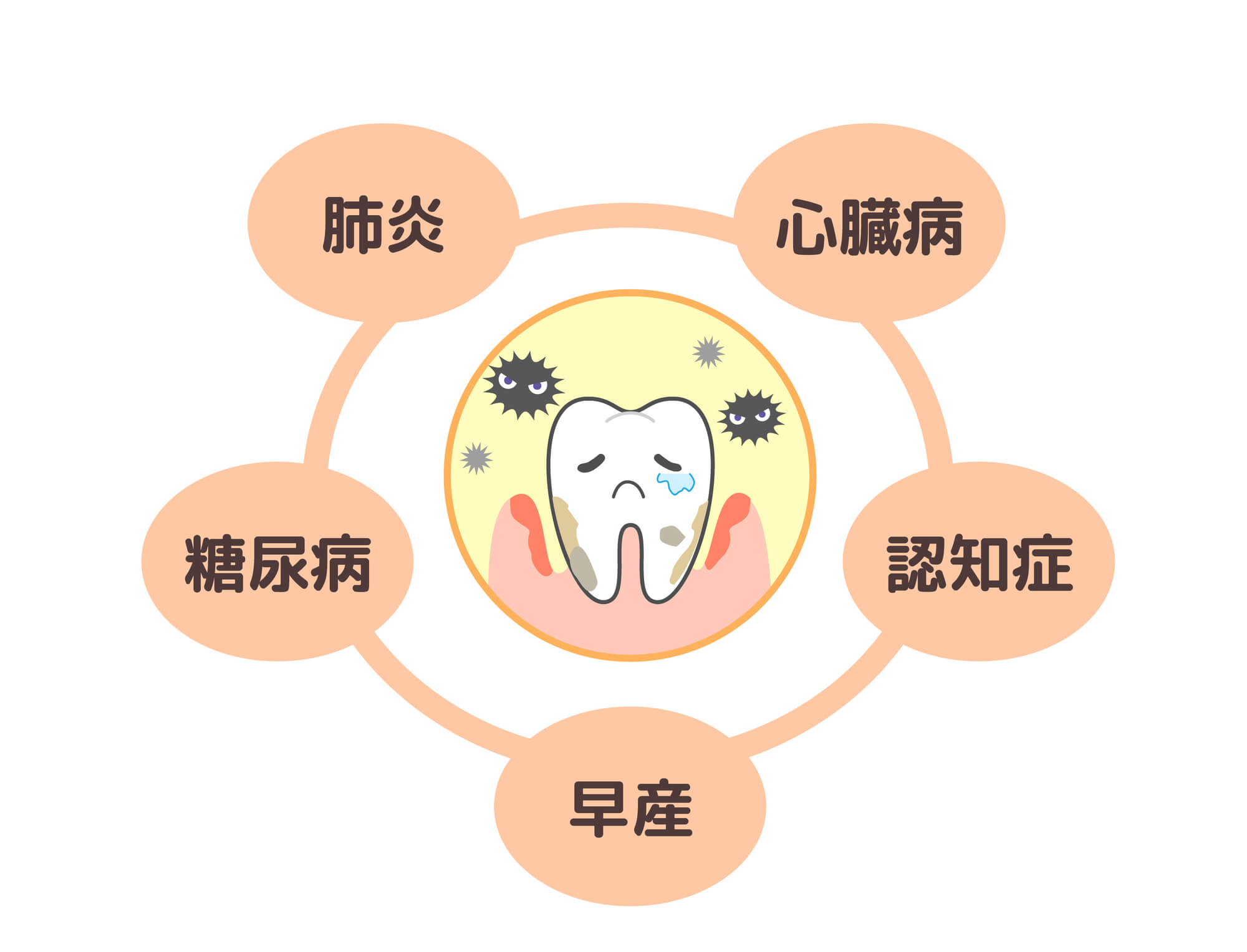 歯周病と全身疾患の関係